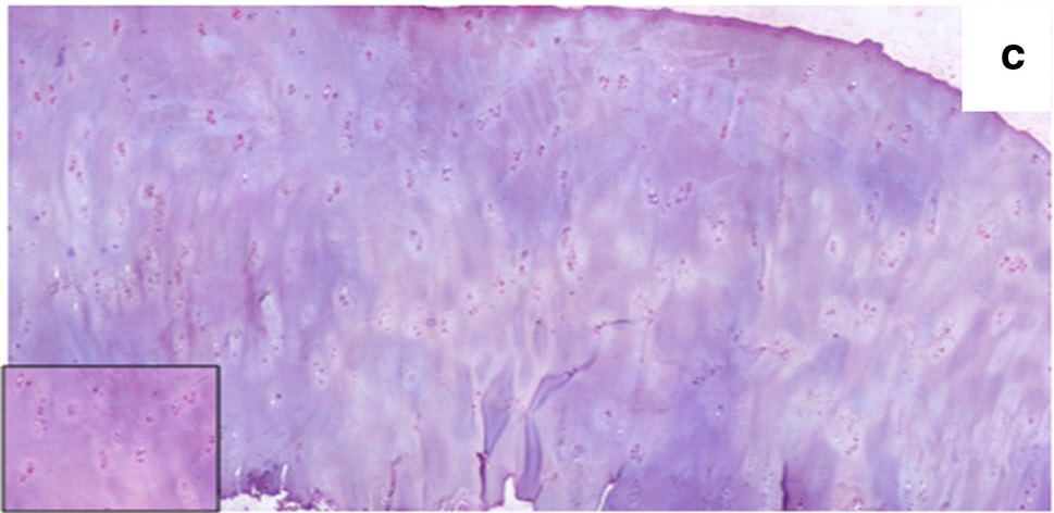 Collagen Type II immunostaining showing presence