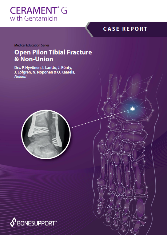 Open Pilon Tibial Fracture & Non-Union https://biotechpromed.com