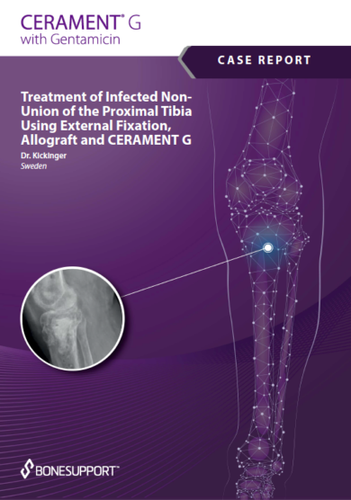 Treatment of Infected Non-Union of the Proximal Tibia CERAMENT G