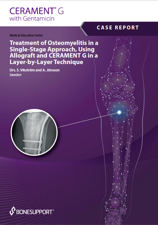 Treatment of Osteomyelitis in a Single-Stage Approach, Using Allograft and CERAMENT G in a Layer by Layer Technique https://biotechpromed.com