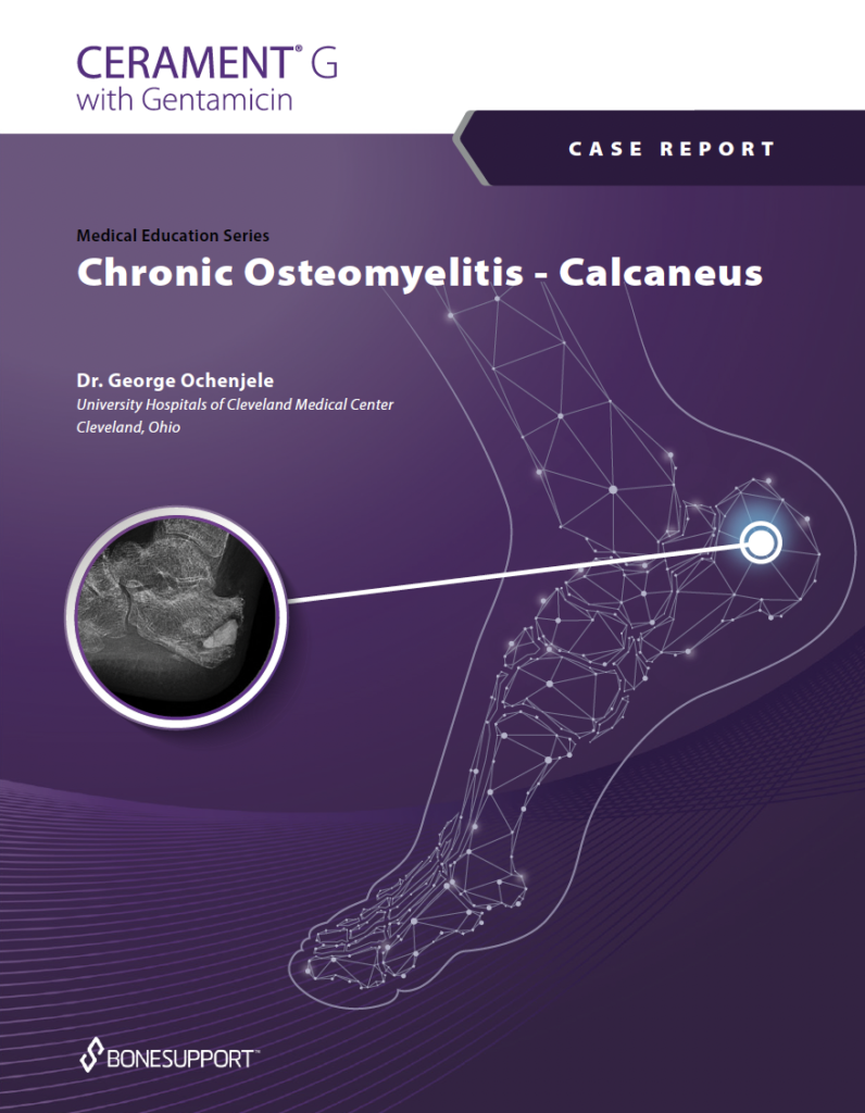 Chronic Osteomyelitis - Calcaneus - Dr. George Ochenjele https://biotechpromed.com