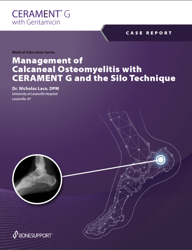 Case Report - Management of Calcaneal Osteomyelitis with CERAMENT G and the Silo Technique Dr. Nicholas Laco, DPM https://biotechpromed.com