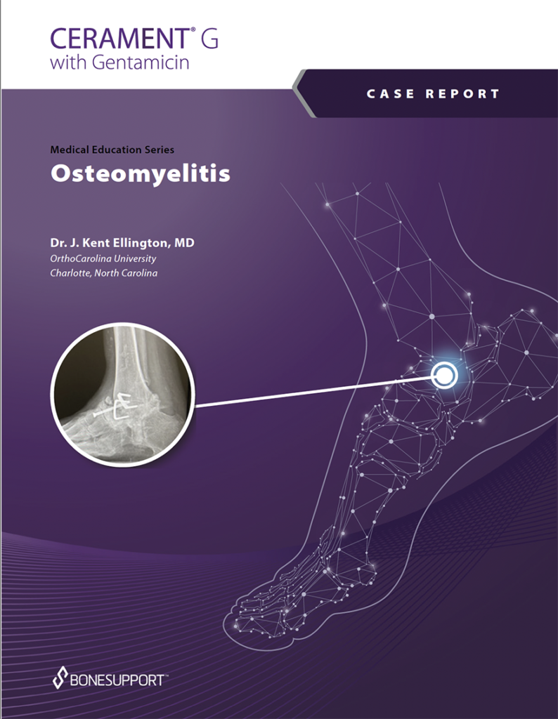 Case Report of Cerament G in Osteomyelitis by Dr. J. Kent Ellington MD https://biotechpromed.com